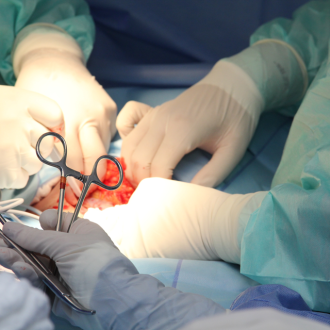 Smrt nenarozeného dítěte byla způsobena transopercí