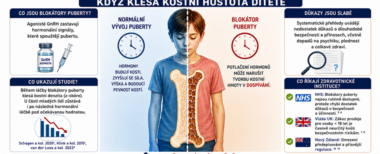 Blokátory puberty a hustota kostí Blokátory puberty a hustota kostí